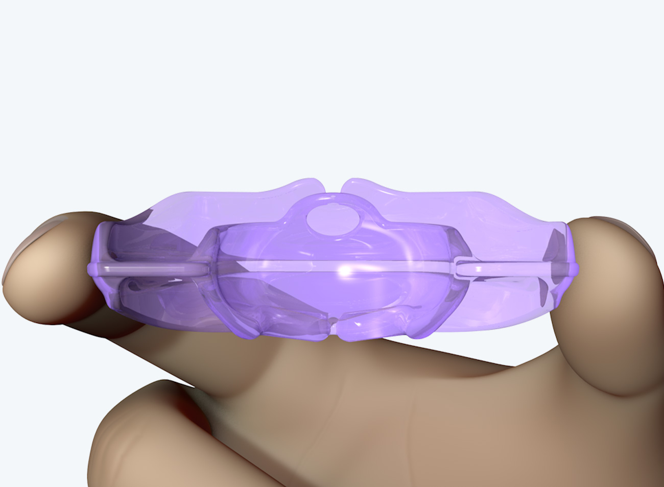 myobrace1 myobrace1